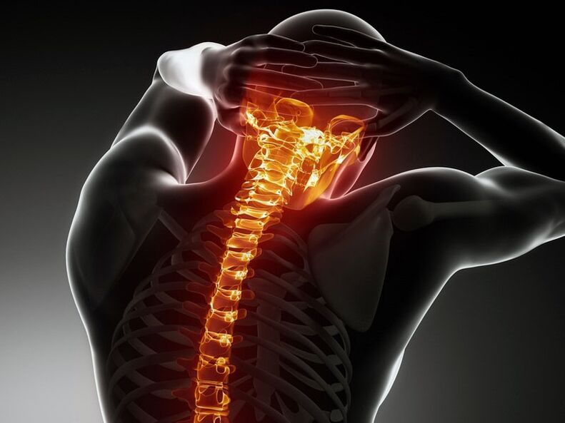 Simptome de osteochondroză