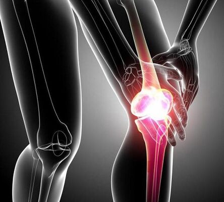 afectarea articulației genunchiului cu artrită și artroză