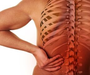 dureri de spate cu osteocondroză lombară