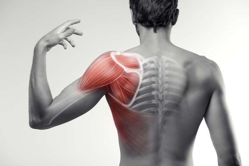 zone cu dureri musculare